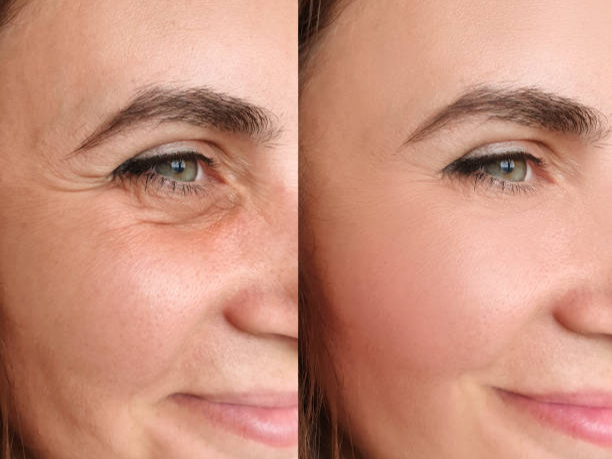 SWISS PRO EYE SERUM